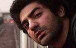 سوختگی شدید بازیگر جوان /عکس سوختگی شدید بازیگر جوان /عکس